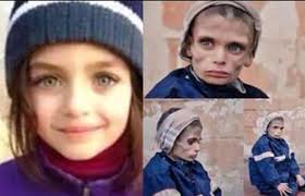   به‌ وێنه‌.. منداڵانی مه‌زایا له‌ برسان ده‌مرن